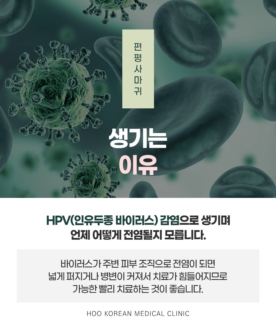 편평사마귀 생기는 이유 HPV 인유두종바이러스 감염 설명