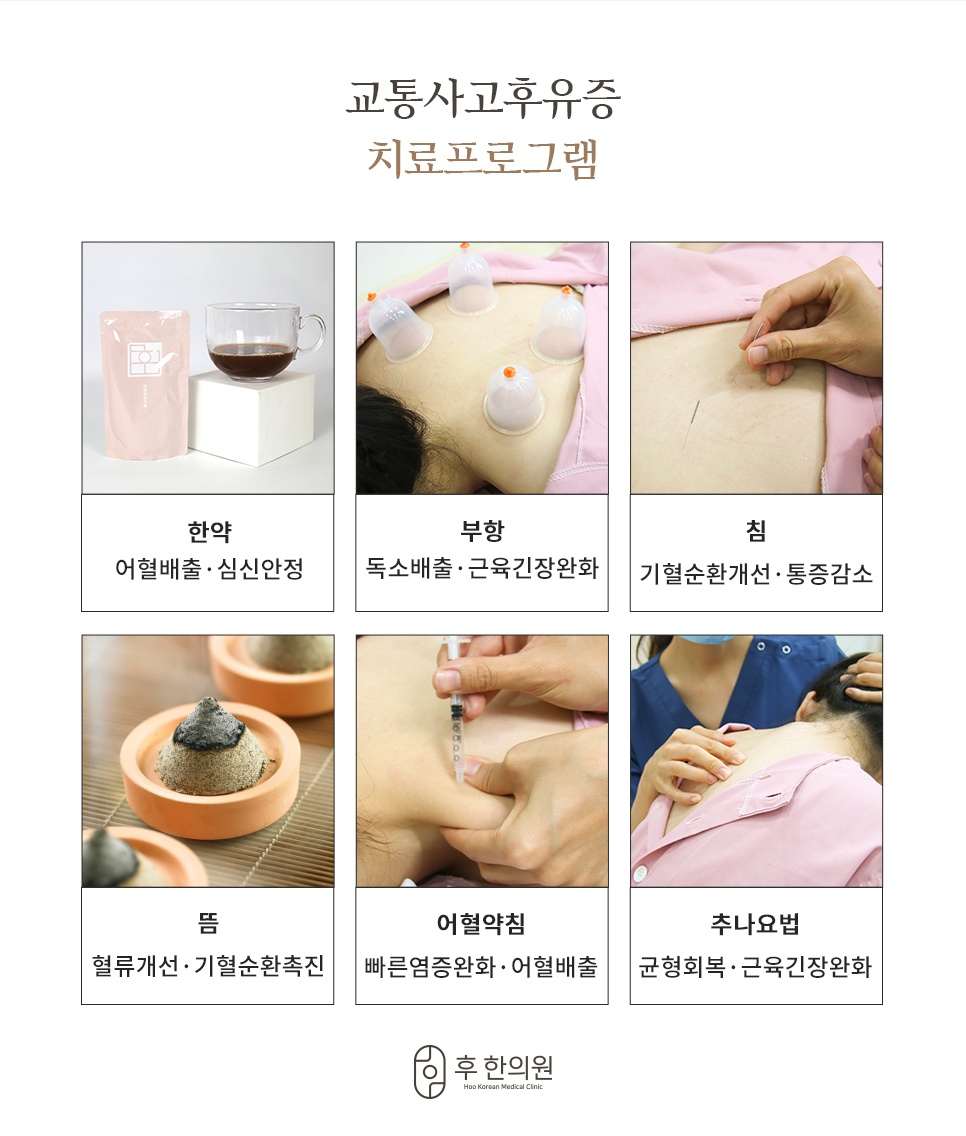 교통사고 후유증 치료프로그램 한약 부항 침 뜸 어혈약침 추나요법