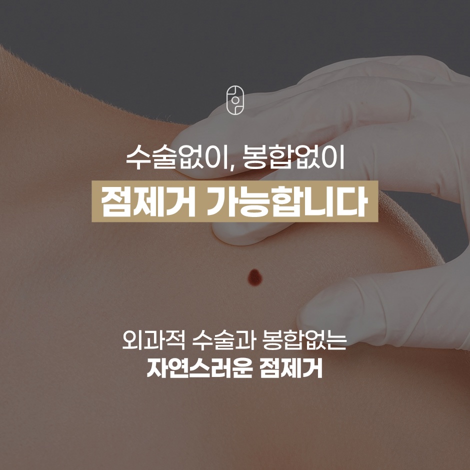 수술 및 봉합 없는 한방 점 제거 안내