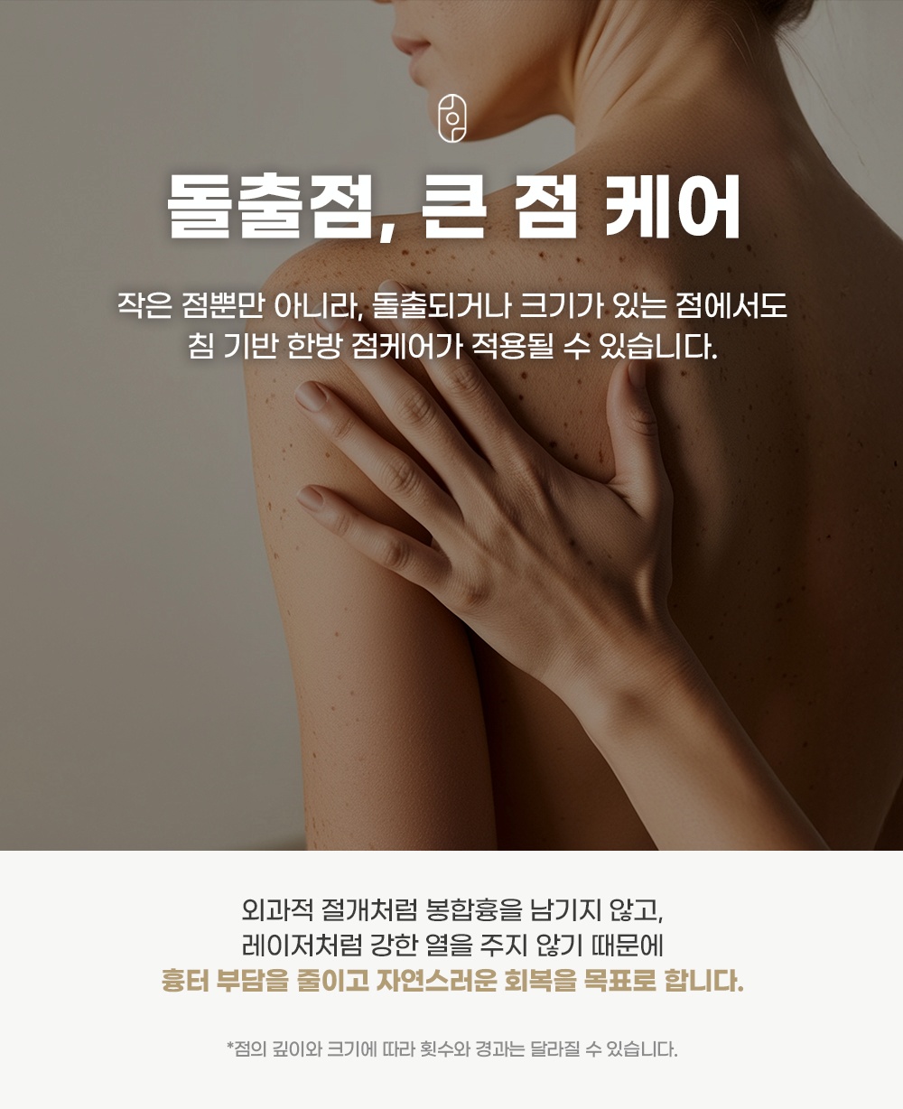 침 기반 한방 돌출점 및 큰 점 케어 특장점 안내