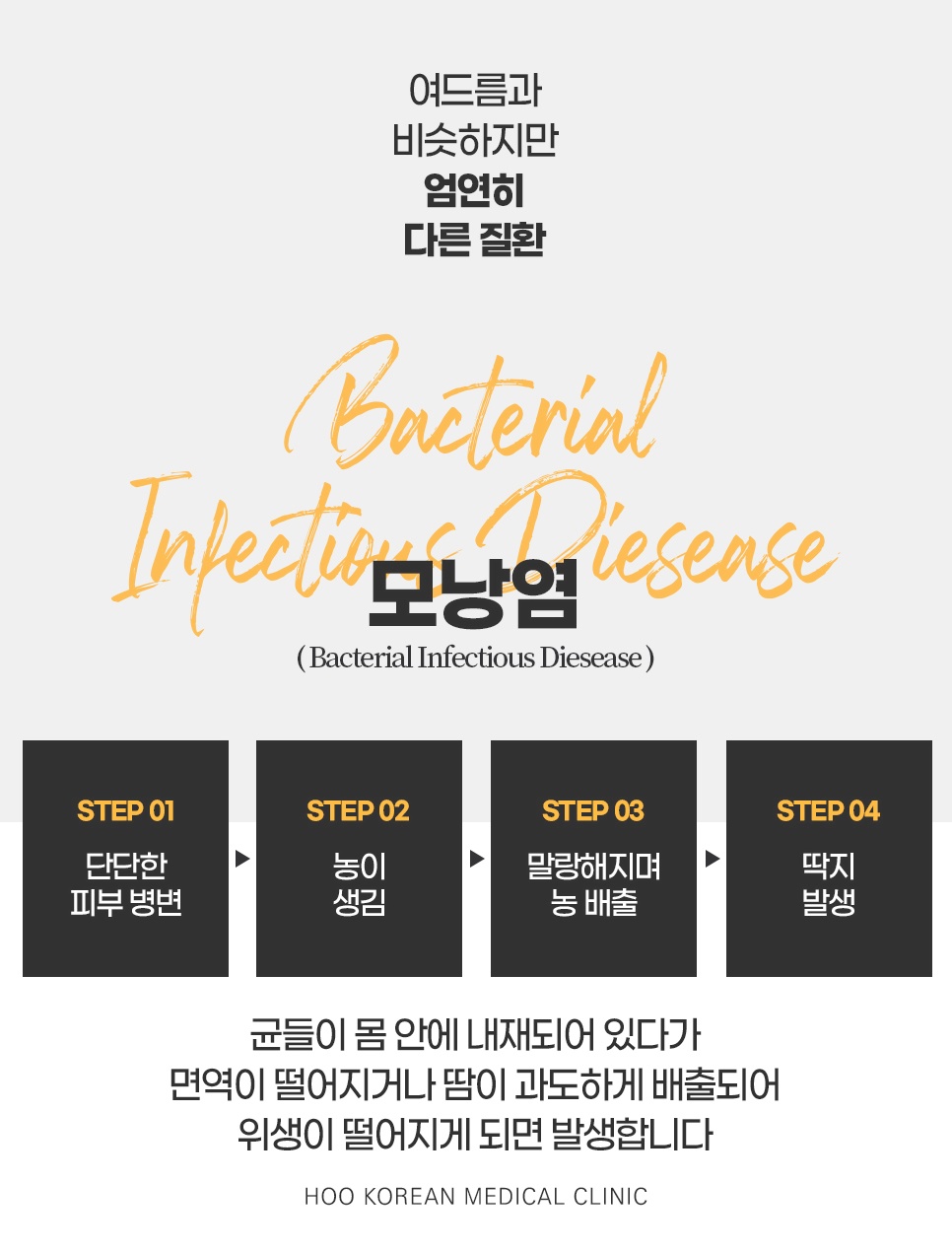 여드름과 다른 피부 질환 모낭염의 진행 단계 4step 안내