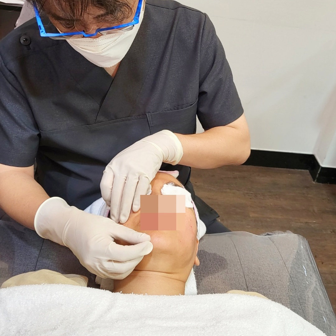 환자 얼굴을 직접 만지며 꼼꼼하게 시술하는 지루성피부염 치료 장면