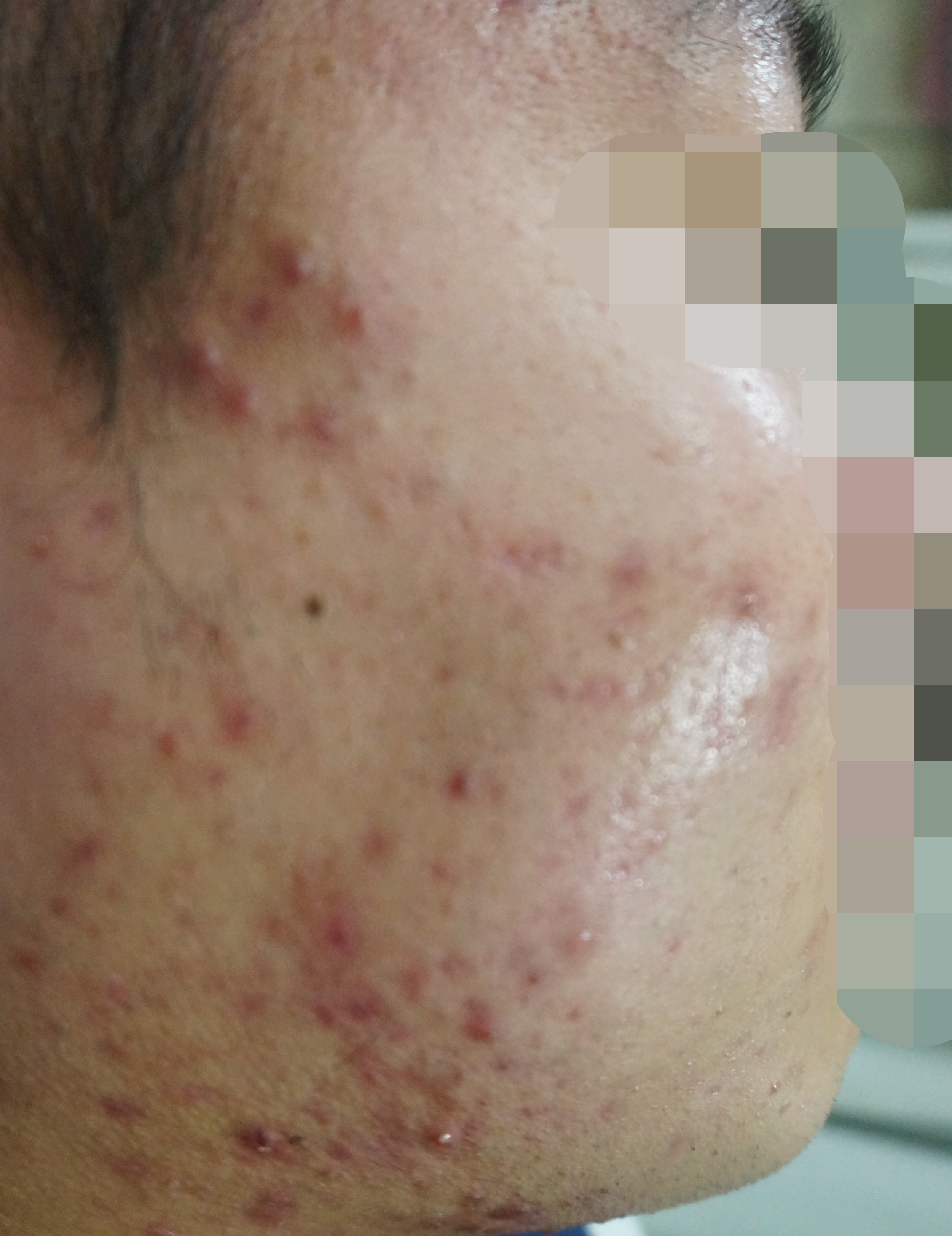 Before